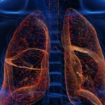 Akciğerlere iyi gelen meyveler