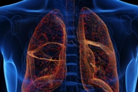 Akciğerlere iyi gelen meyveler